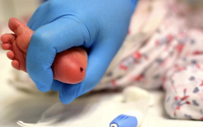 PROPONEN REFORMAS PARA FOMENTAR Y EJECUTAR PROGRAMAS DE TAMIZAJE NEONATAL